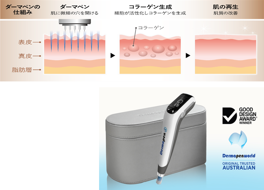 ダーマペンの美肌効果