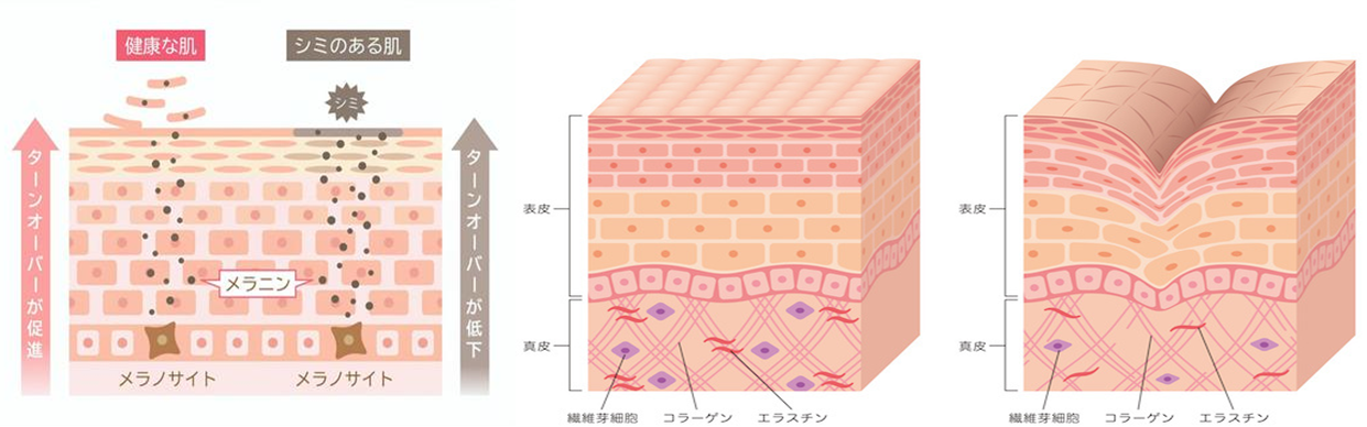 ダーマペンの美肌効果